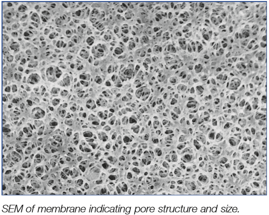 多孔質構造や孔径の大きさを示すメンブレンの電子顕微鏡像