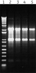 RNAspinで精製したtotalRNAの電気泳動写真