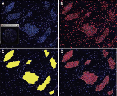 図2 幹細胞コロニーおよびフィーダー細胞の画像解析