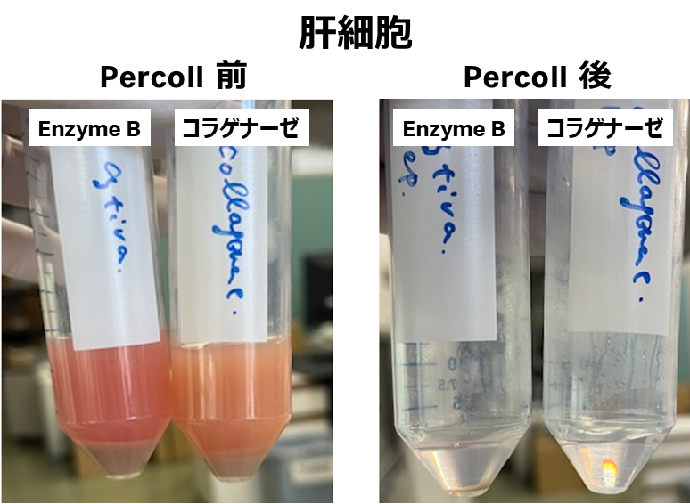 肝細胞 Percoll前後の写真