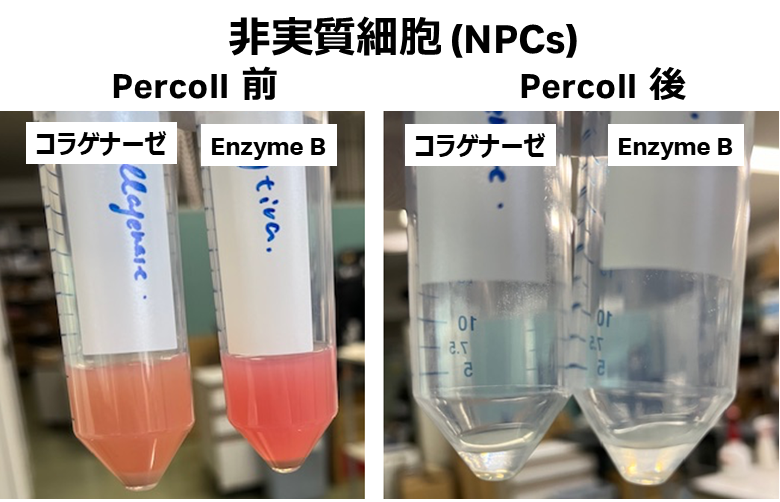 非実質細胞 (NPCs) Percoll前後の写真